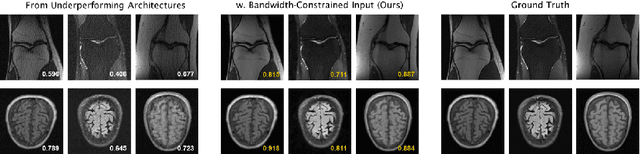 Figure 1 for Towards Architecture-Insensitive Untrained Network Priors for Accelerated MRI Reconstruction