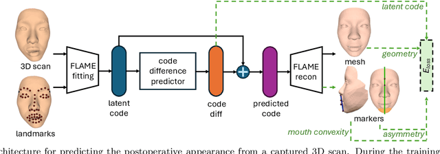 Figure 1 for Facial Surgery Preview Based on the Orthognathic Treatment Prediction