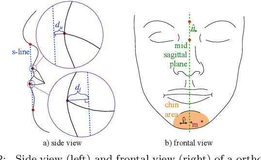 Figure 3 for Facial Surgery Preview Based on the Orthognathic Treatment Prediction