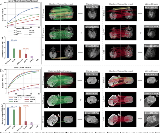 Figure 2 for MatchAnything: Universal Cross-Modality Image Matching with Large-Scale Pre-Training