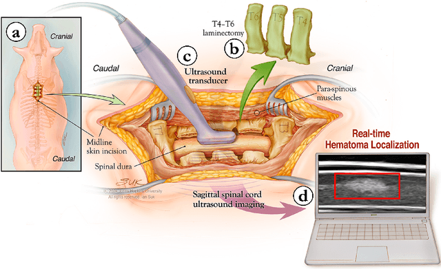 Figure 1 for A novel open-source ultrasound dataset with deep learning benchmarks for spinal cord injury localization and anatomical segmentation