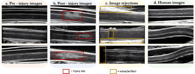 Figure 3 for A novel open-source ultrasound dataset with deep learning benchmarks for spinal cord injury localization and anatomical segmentation