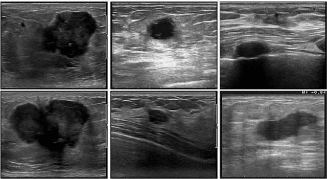 Figure 2 for Breast tumor classification based on self-supervised contrastive learning from ultrasound videos