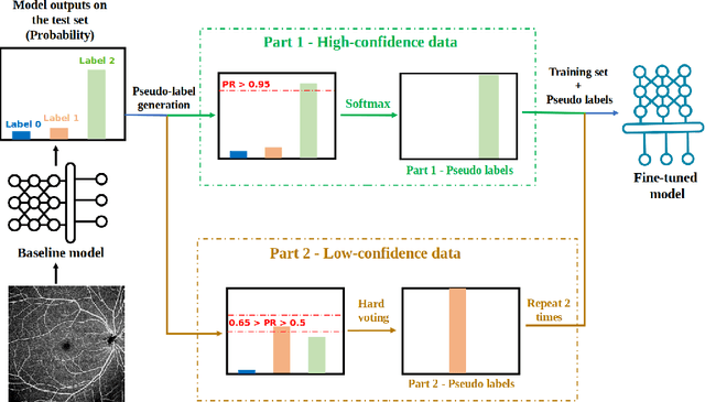 Figure 4 for Segmentation, Classification, and Quality Assessment of UW-OCTA Images for the Diagnosis of Diabetic Retinopathy