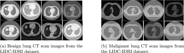 Figure 3 for Multi-Attention Stacked Ensemble for Lung Cancer Detection in CT Scans