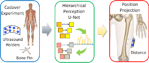 Figure 1 for Deep Learning based acoustic measurement approach for robotic applications on orthopedics