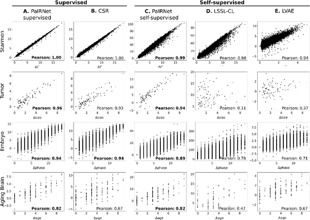 Figure 3 for Learning to Compare Longitudinal Images