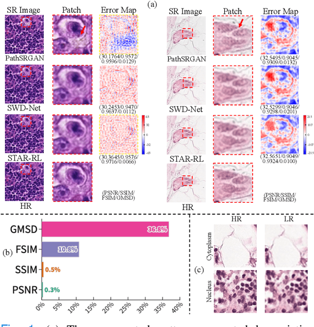 Figure 1 for Spatial-temporal Hierarchical Reinforcement Learning for Interpretable Pathology Image Super-Resolution