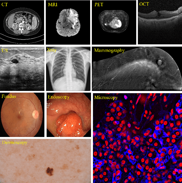 Figure 1 for MCP-MedSAM: A Powerful Lightweight Medical Segment Anything Model Trained with a Single GPU in Just One Day