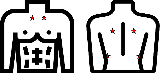 Figure 3 for Detecting Respiratory Pathologies Using Convolutional Neural Networks and Variational Autoencoders for Unbalancing Data