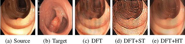 Figure 2 for Frequency-Based Federated Domain Generalization for Polyp Segmentation