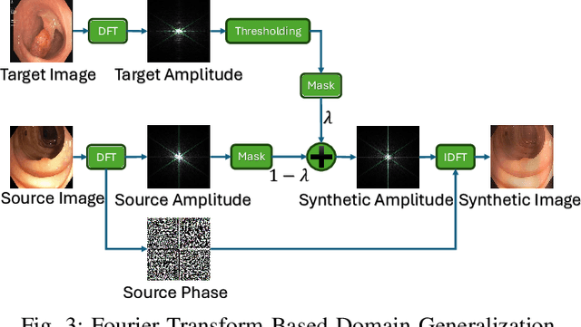 Figure 3 for Frequency-Based Federated Domain Generalization for Polyp Segmentation