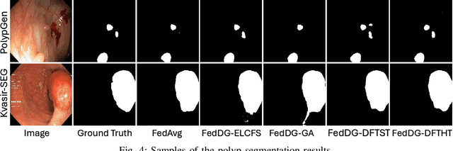 Figure 4 for Frequency-Based Federated Domain Generalization for Polyp Segmentation