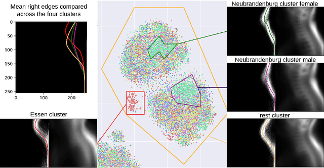 Figure 3 for Detecting Unforeseen Data Properties with Diffusion Autoencoder Embeddings using Spine MRI data