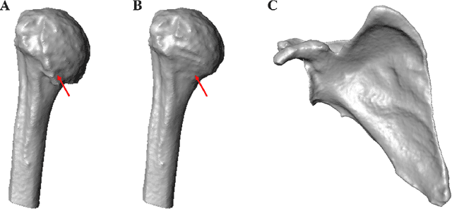 Figure 3 for Cascade learning in multi-task encoder-decoder networks for concurrent bone segmentation and glenohumeral joint assessment in shoulder CT scans