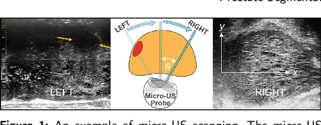 Figure 1 for MicroSegNet: A Deep Learning Approach for Prostate Segmentation on Micro-Ultrasound Images