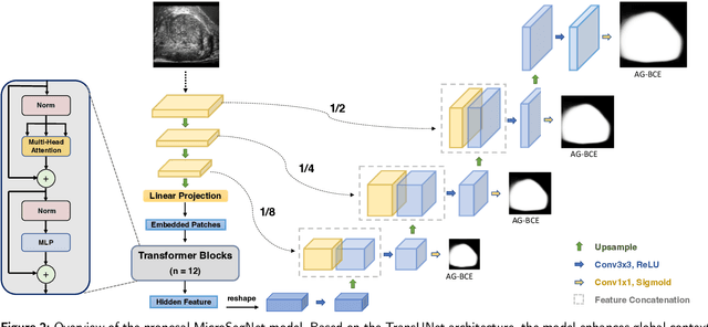 Figure 3 for MicroSegNet: A Deep Learning Approach for Prostate Segmentation on Micro-Ultrasound Images