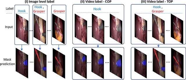 Figure 1 for Disentangling spatio-temporal knowledge for weakly supervised object detection and segmentation in surgical video