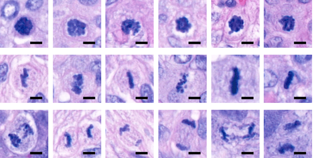 Figure 3 for Z-Stack Scanning can Improve AI Detection of Mitosis: A Case Study of Meningiomas