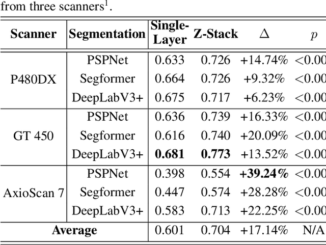 Figure 4 for Z-Stack Scanning can Improve AI Detection of Mitosis: A Case Study of Meningiomas