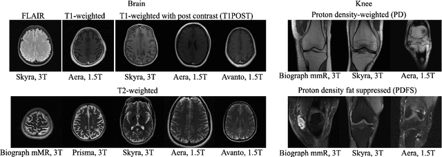 Figure 1 for Robustness of Deep Learning for Accelerated MRI: Benefits of Diverse Training Data