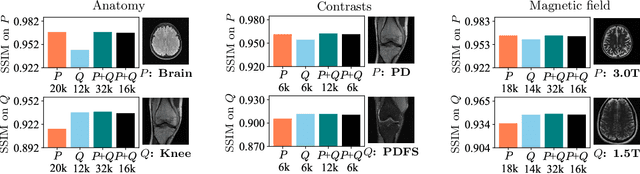 Figure 3 for Robustness of Deep Learning for Accelerated MRI: Benefits of Diverse Training Data