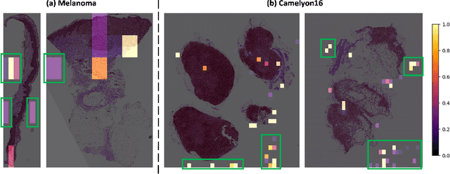 Figure 1 for Semantics-Aware Attention Guidance for Diagnosing Whole Slide Images