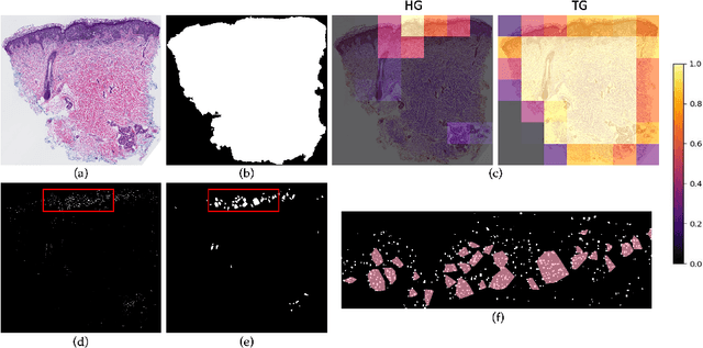 Figure 4 for Semantics-Aware Attention Guidance for Diagnosing Whole Slide Images