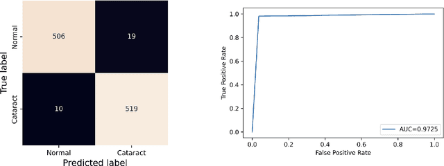 Figure 3 for A CNN-LSTM Combination Network for Cataract Detection using Eye Fundus Images