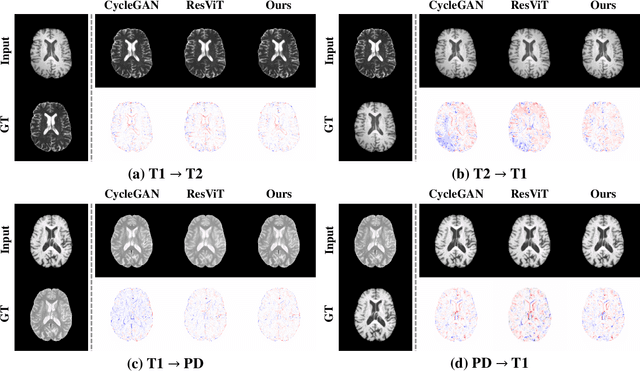 Figure 4 for SAM-I2I: Unleash the Power of Segment Anything Model for Medical Image Translation