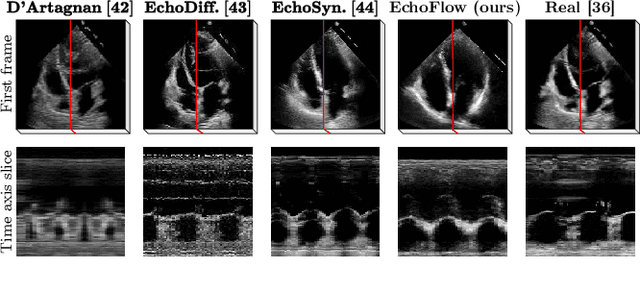 Figure 2 for EchoFlow: A Foundation Model for Cardiac Ultrasound Image and Video Generation