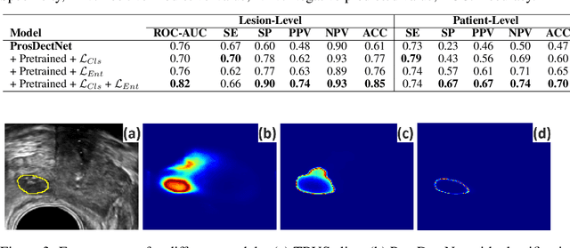 Figure 4 for ProsDectNet: Bridging the Gap in Prostate Cancer Detection via Transrectal B-mode Ultrasound Imaging