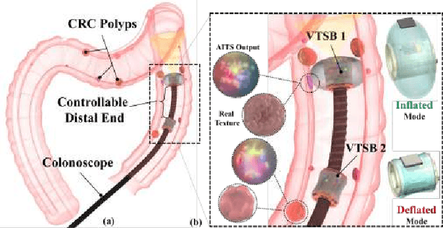 Figure 1 for Design and Development of a Novel Soft and Inflatable Tactile Sensing Balloon for Early Diagnosis of Colorectal Cancer Polyps