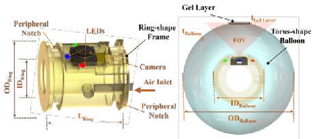 Figure 2 for Design and Development of a Novel Soft and Inflatable Tactile Sensing Balloon for Early Diagnosis of Colorectal Cancer Polyps