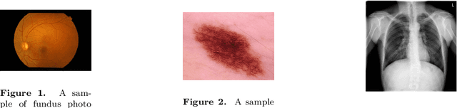 Figure 1 for Multi-Label Classification of Thoracic Diseases using Dense Convolutional Network on Chest Radiographs