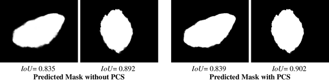 Figure 2 for TransResNet: Integrating the Strengths of ViTs and CNNs for High Resolution Medical Image Segmentation via Feature Grafting