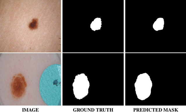 Figure 3 for TransResNet: Integrating the Strengths of ViTs and CNNs for High Resolution Medical Image Segmentation via Feature Grafting