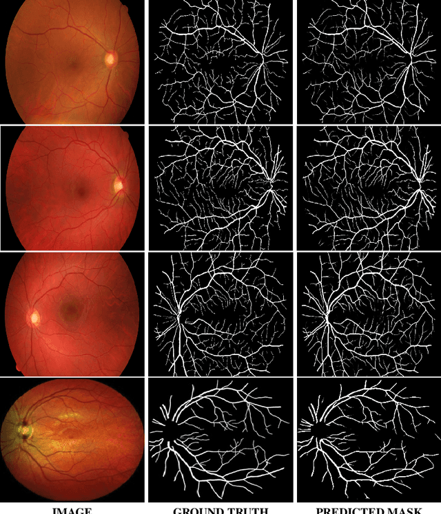 Figure 4 for TransResNet: Integrating the Strengths of ViTs and CNNs for High Resolution Medical Image Segmentation via Feature Grafting