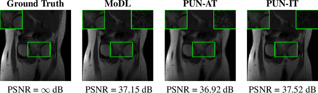 Figure 2 for Pruning Unrolled Networks (PUN) at Initialization for MRI Reconstruction Improves Generalization