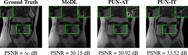 Figure 3 for Pruning Unrolled Networks (PUN) at Initialization for MRI Reconstruction Improves Generalization