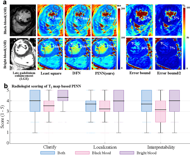 Figure 4 for Error Bound Analysis of Physics-Informed Neural Networks-Driven T2 Quantification in Cardiac Magnetic Resonance Imaging