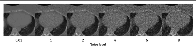 Figure 4 for A quality assurance framework for real-time monitoring of deep learning segmentation models in radiotherapy