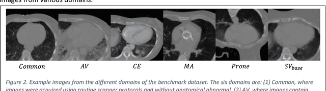 Figure 2 for A quality assurance framework for real-time monitoring of deep learning segmentation models in radiotherapy