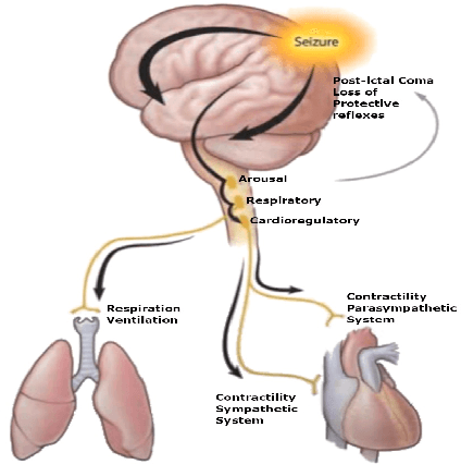 Figure 2 for Epilepsy Seizure Detection: Anatomy and Analysis