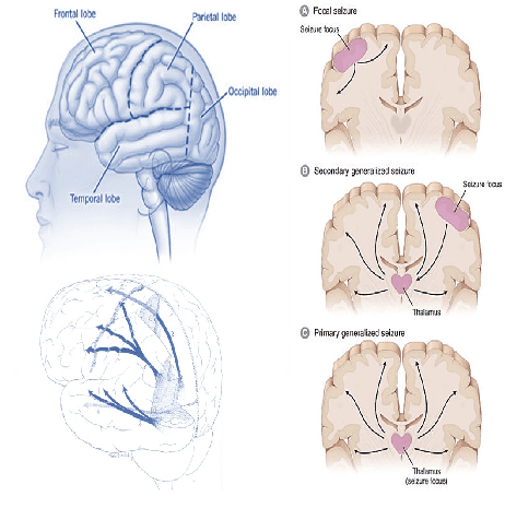 Figure 3 for Epilepsy Seizure Detection: Anatomy and Analysis