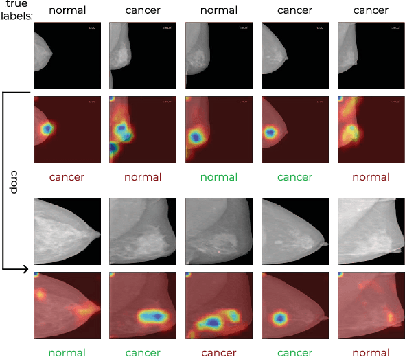 Figure 3 for MamT$^4$: Multi-view Attention Networks for Mammography Cancer Classification