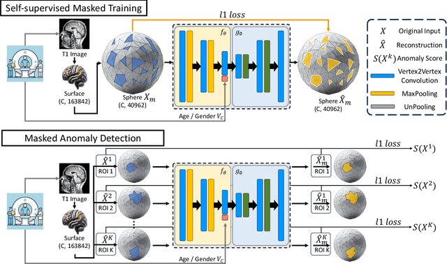 Figure 1 for Self-Supervised Masked Mesh Learning for Unsupervised Anomaly Detection on 3D Cortical Surfaces