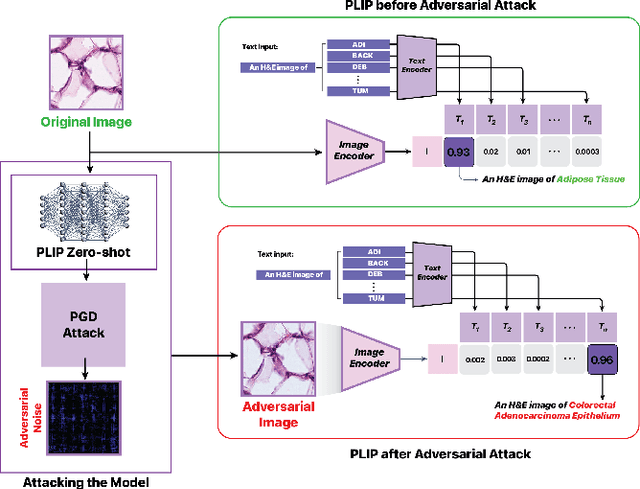 Figure 1 for Vulnerabilities Unveiled: Adversarially Attacking a Multimodal Vision Language Model for Pathology Imaging