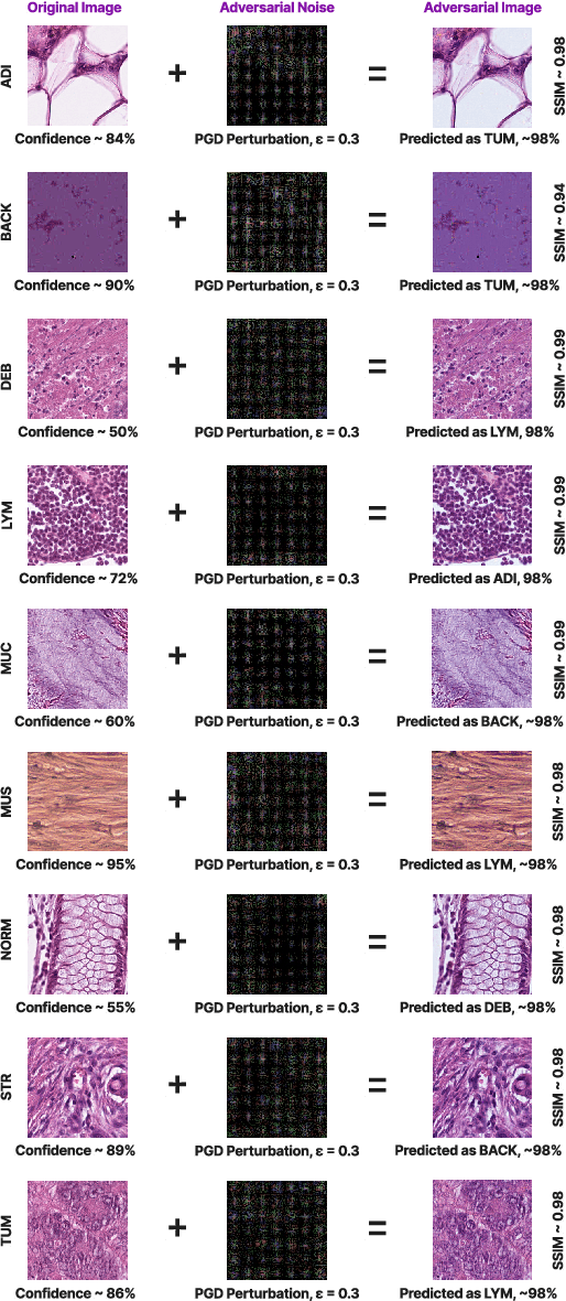 Figure 2 for Vulnerabilities Unveiled: Adversarially Attacking a Multimodal Vision Language Model for Pathology Imaging