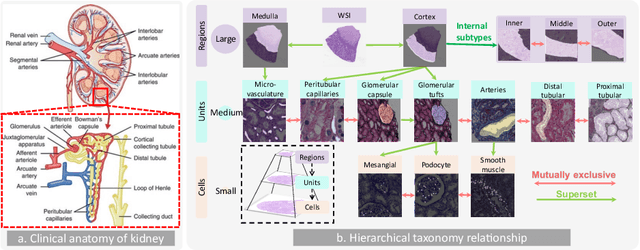 Figure 1 for HATs: Hierarchical Adaptive Taxonomy Segmentation for Panoramic Pathology Image Analysis